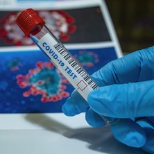 Epidemia koronawirusa. Łącznie 592 zakażenia w regionie